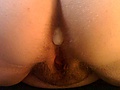 anal_nut.jpg