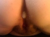 anal_nut.jpg