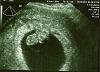My Wife is Pregnant-baby0003.jpg